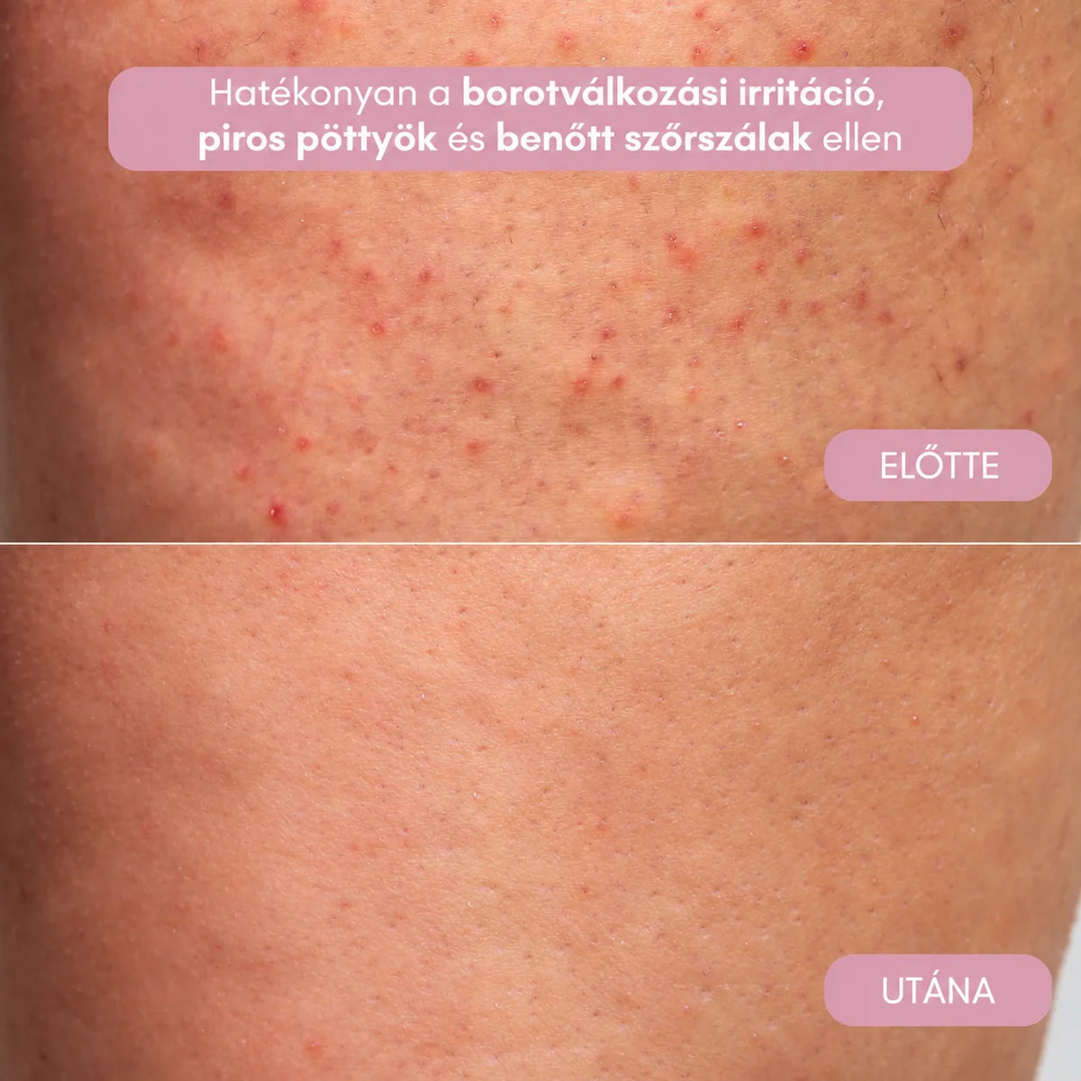VELISSA™ Smooth Pro